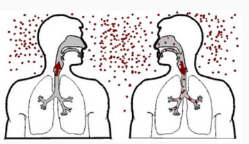 AAMR - Información de enfermedades respiratorias AAMR - Información de enfermedades respiratorias